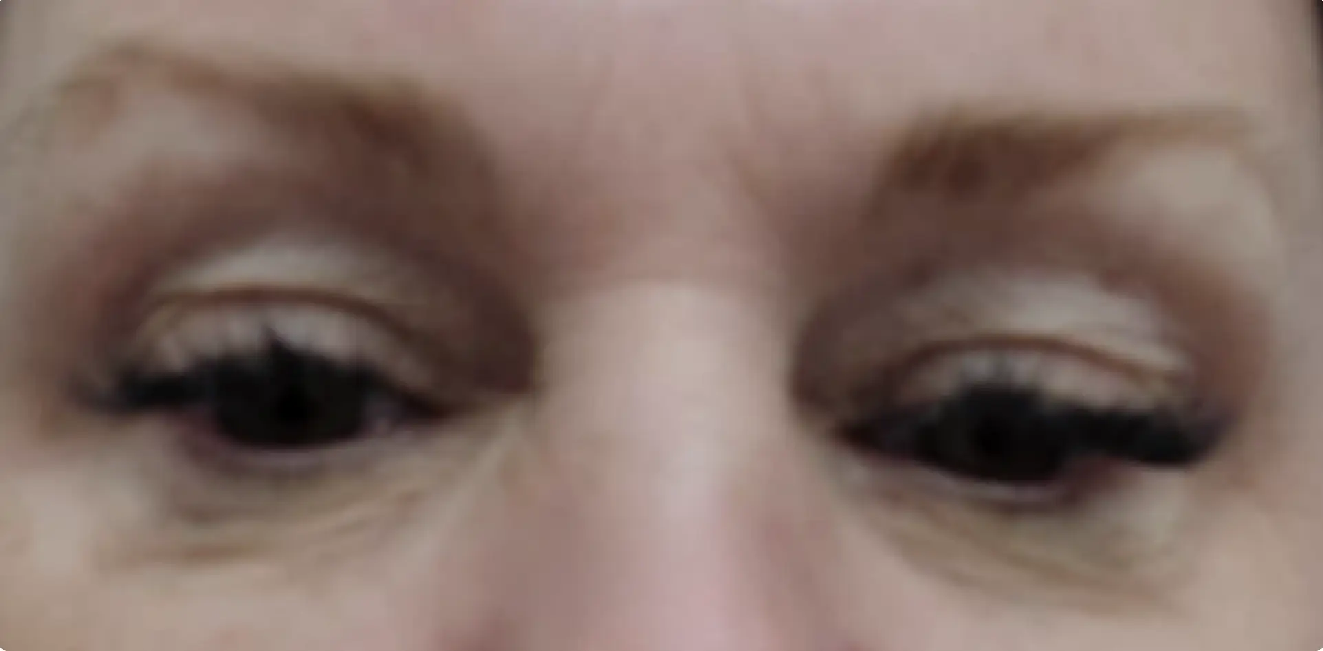 22 (1)
