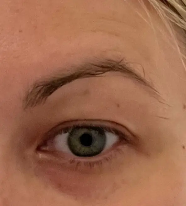 33 (1)